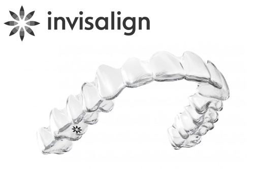 マウスピース型矯正装置（インビザライン）とは？